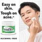 Stridex 55 Soft Touch Pads Sensitive with Aloe Salicylic Acid 0.5% w/w Acne Medication