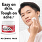 Stridex 55 Soft Touch Pads Maximum Salicylic Acid 2% w/w Acne Medication