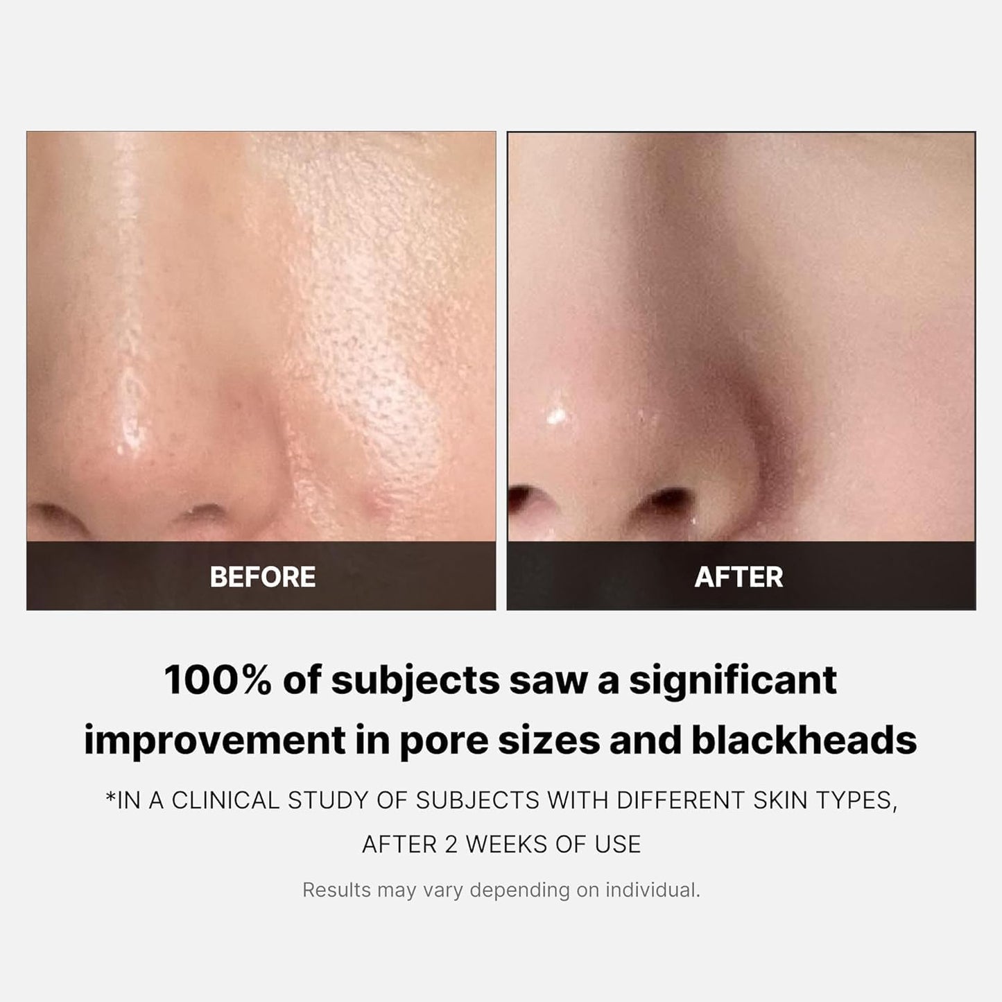 Medicube Zero Pore Pad 155g