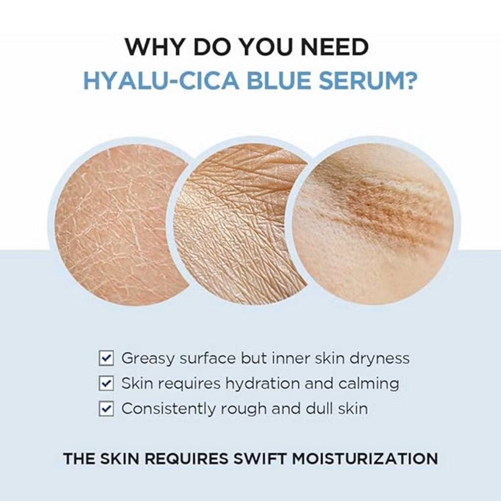 Skin1004 Madagascar Centella Hyalu-cica Blue Serum 50ml