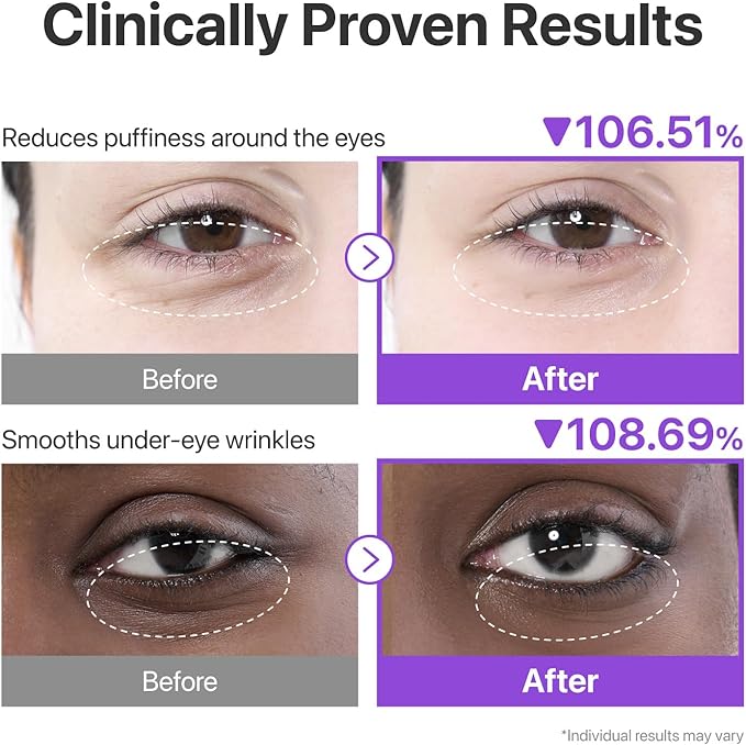 Numbuzin 9+ NMN Collagen Under Eye Patches