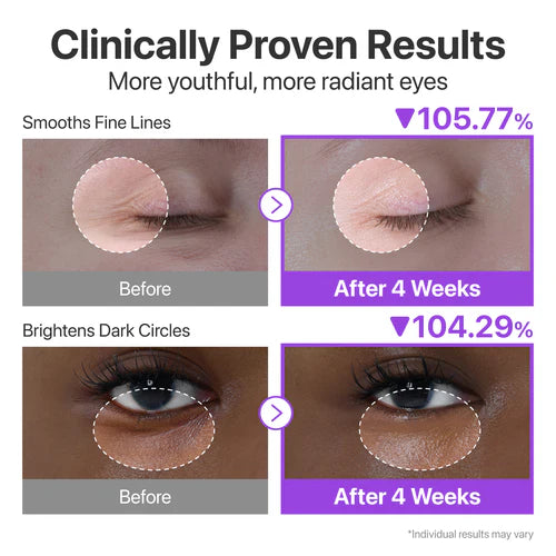 Numbuzin 9+ NMN Retinol Volumetox Eye Cream NMN+Retinal+50 Peptides 10ml