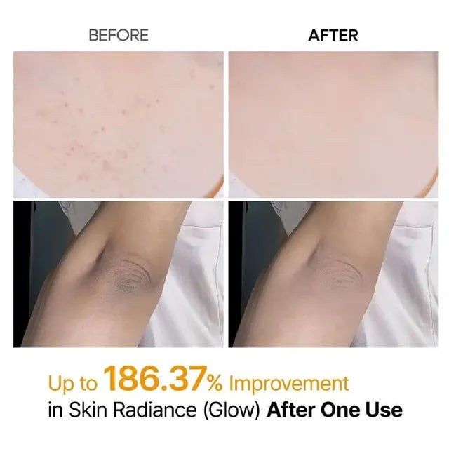 Dr.Melaxin Peel Shot Body and Foot Exfoliating Kojic Acid Turmeric Spray 200ml